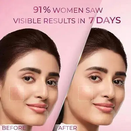 POND'S Anti-Pigmentation Serum 28ml | 12% Gluta-Niacinamide Complex | Reduces Pigmentation from Day 7 | Bright & Flawless Skin - Sellzova