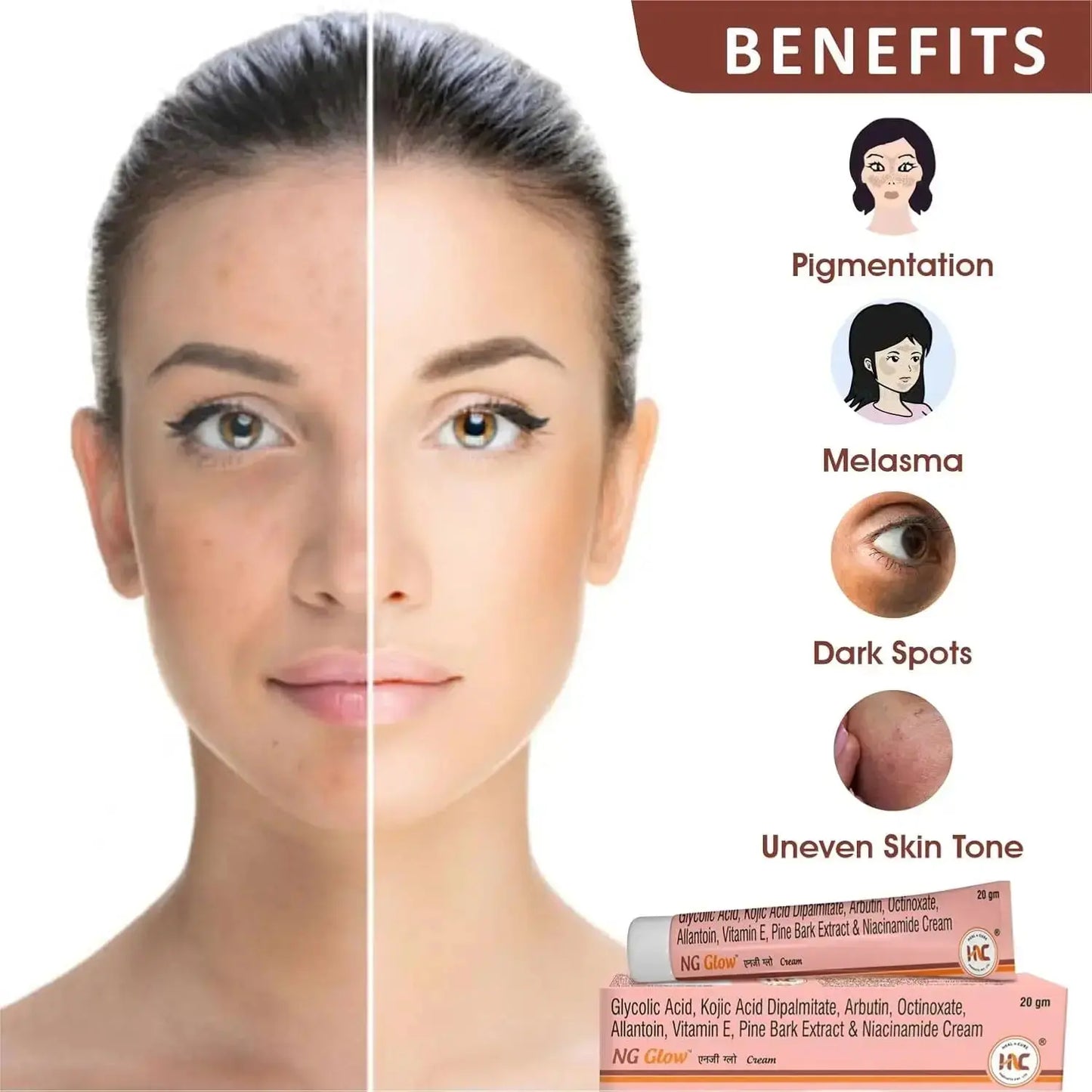 Heal N Cure Glow Cream Pack of 2 (20gm Each) | Kojic Acid & Glycolic Acid | Pigmentation, Dark Spot & Blemish Remover - Sellzova